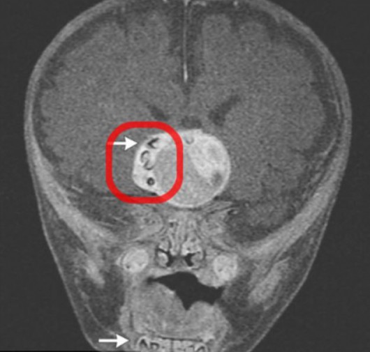 Zęby widoczne na zdjęciu rentgenowskim.  Foto:  University of Maryland Medical Center